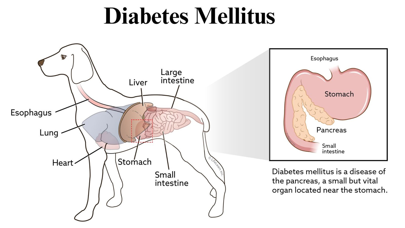 Diabetes Mellitus